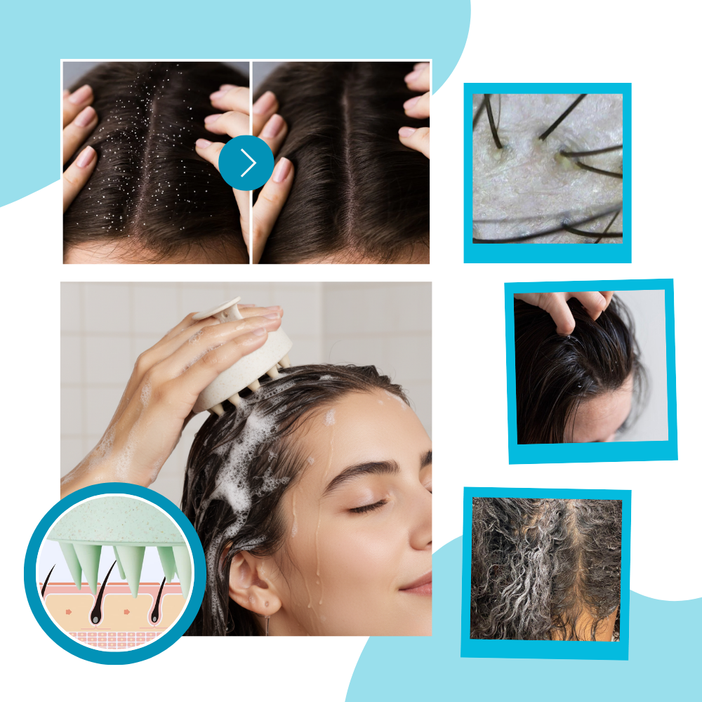 Revitalizing Cleanse Hair Scalp Massager Brush - Ozerty