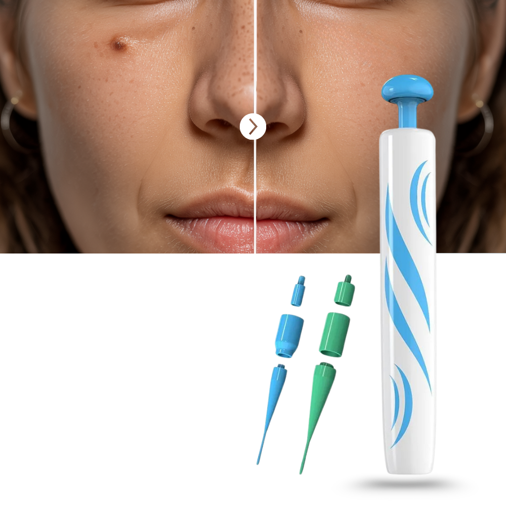 Skin Tag Removal Pro - Ozerty