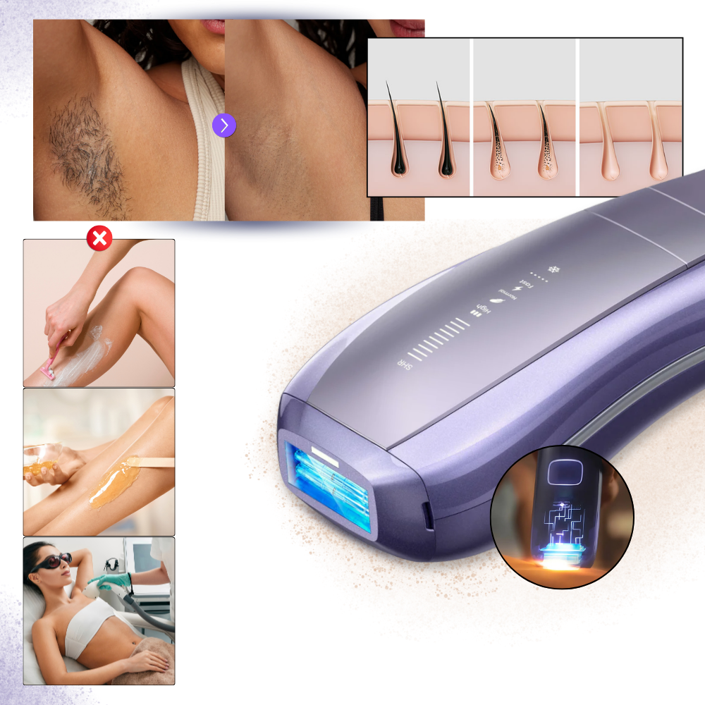 SkinSync Hair Removal Device - Ozerty