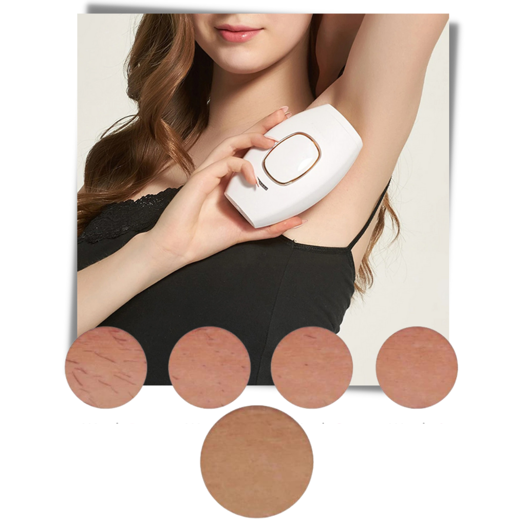 Mini IPL Laser Hair Remover