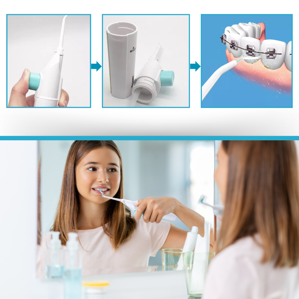 Air Powered Teeth Water Flosser - Ozerty