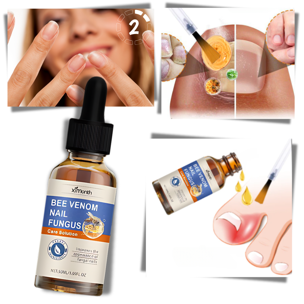 Fast Acting Relief Nail Fungal Drops - Ozerty