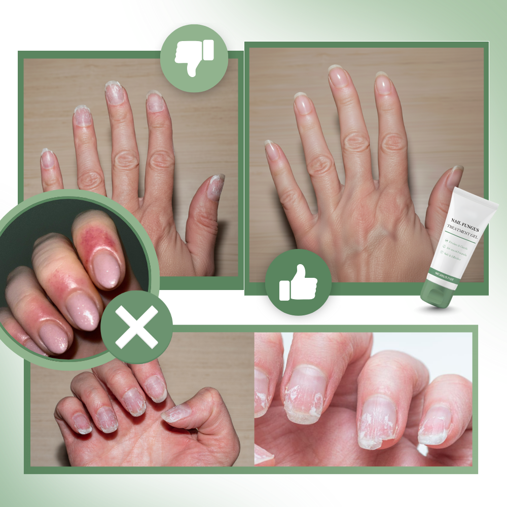 Nail Revitalizing & Moisturizing Gel - Ozerty