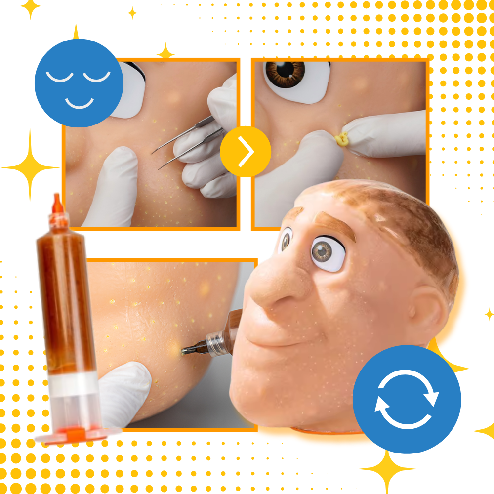 Relaxing Silicone Pimple Pop Toy - Ozerty