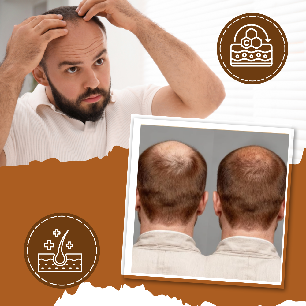 Soft & Nourished Batana Oil Hair Mask - Ozerty