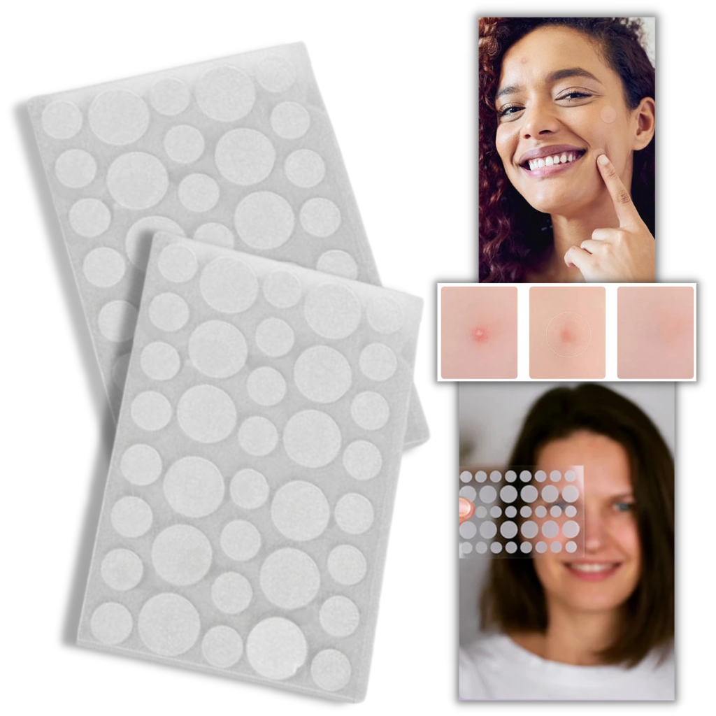 36-Pack Invisible Acne Patches -