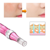 Dermal Microneedling Pen