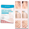 Skin tag removal treatment patch