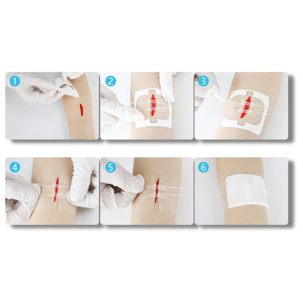 Water-proof wound adhesive - Ozerty