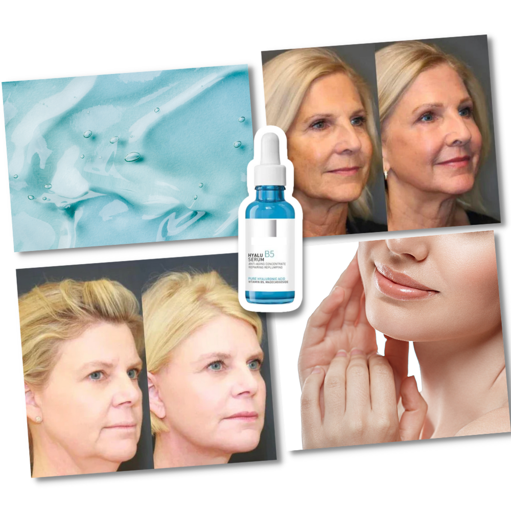 Rejuvenating Hyalu B5 Hyaluronic Acid Serum - Ozerty