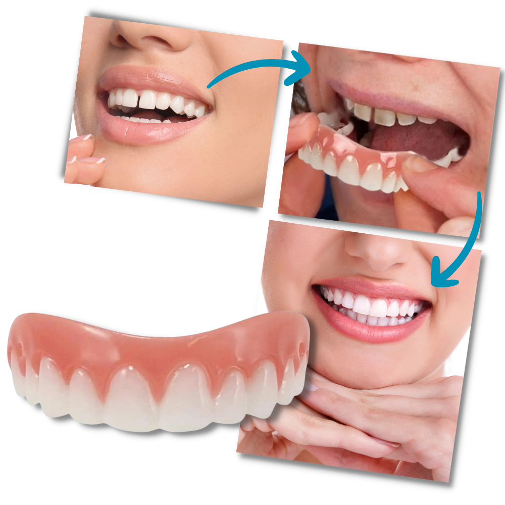 Snap-On Veneer Teeth - Ozerty